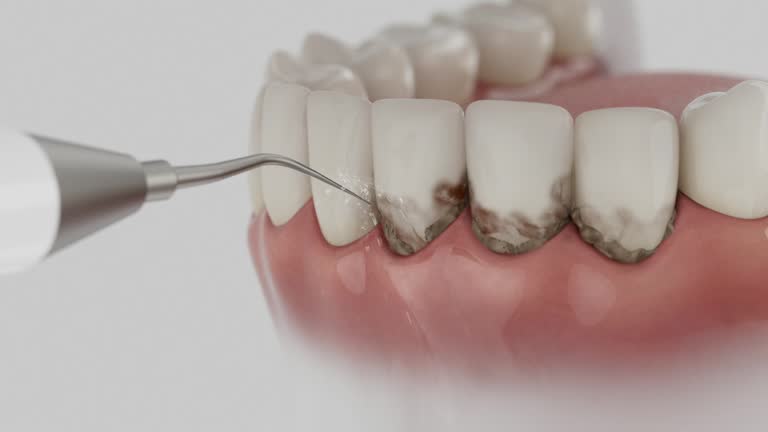 Reliable Wisdom Tooth Removal contractor in Limestone County County, AL by Dentist Open Now